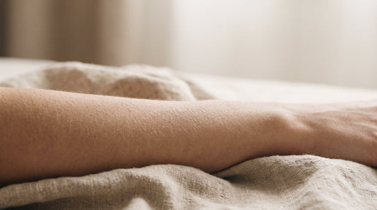Close-up of dry, slightly flaky skin on a forearm resting on linen